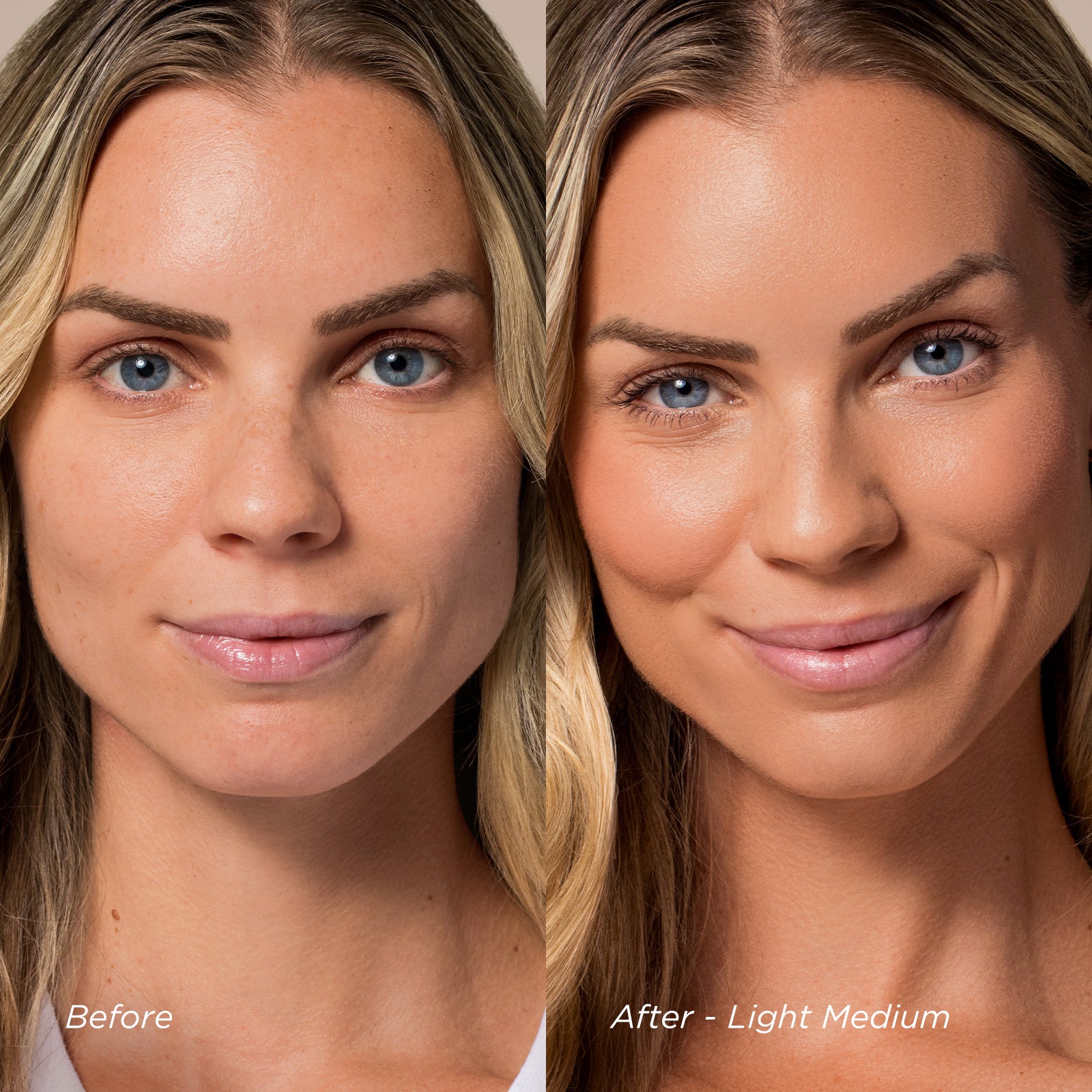 Before and after comparison of a woman's face with text labels 'Before' and 'After - Light Medium'.