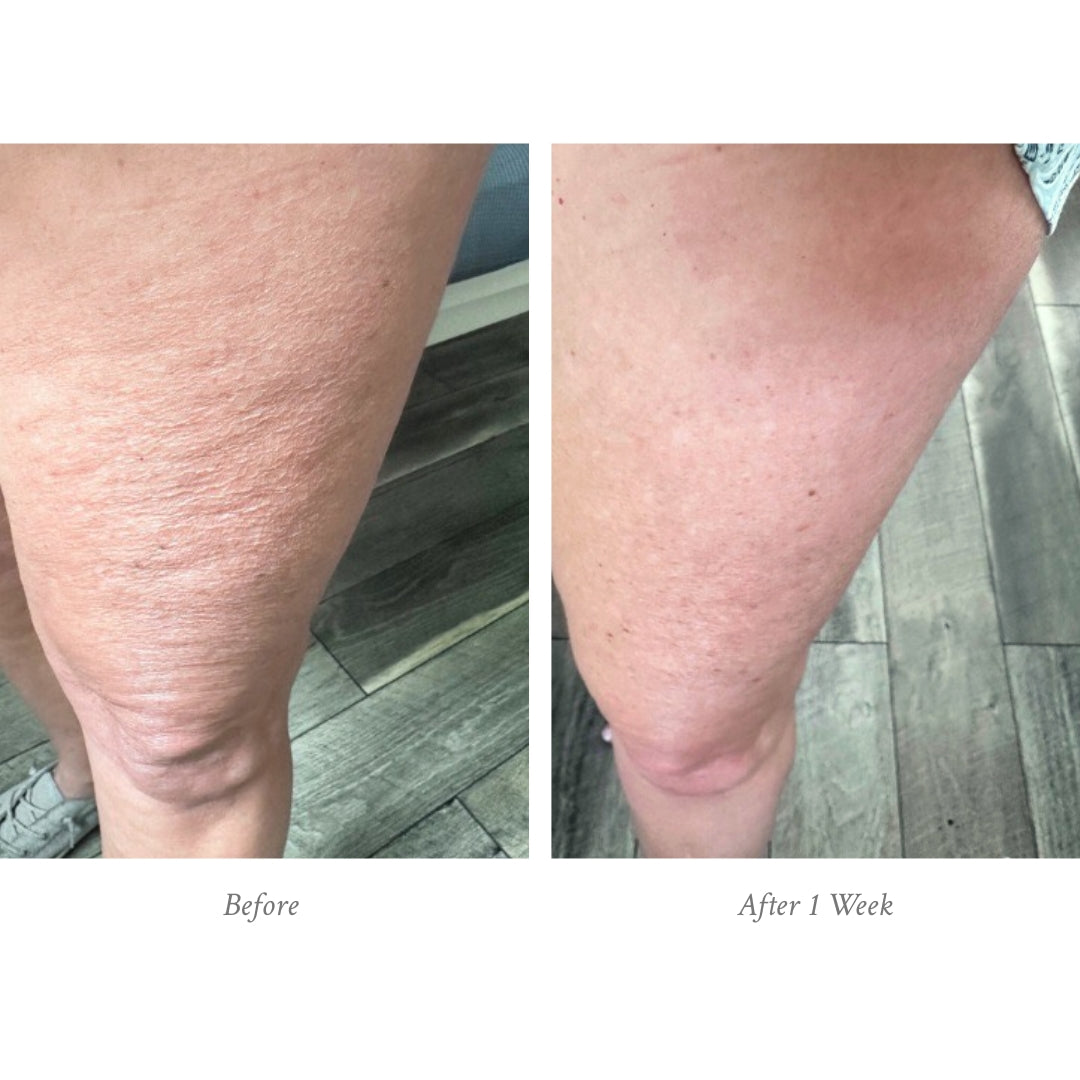 Before and after comparison of a person's leg on a wooden floor.